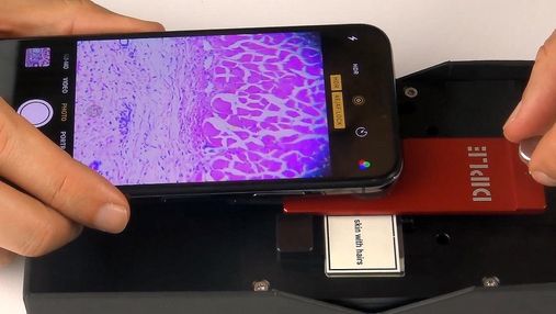Створено мікроскоп для смартфона з 1000-кратним зумом: відео