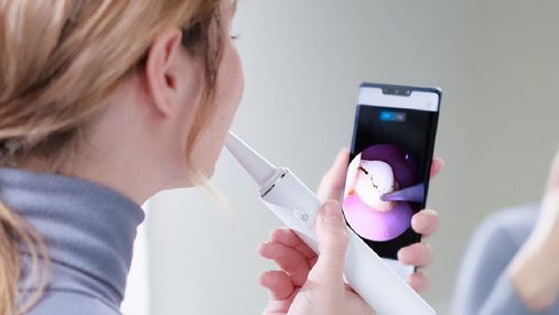 Xiaomi представила домашний скалер для удаления зубного налета